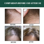 OUHOE Ginger Hair Care Serum 30ml – Scalp & Root Care | Aladinae