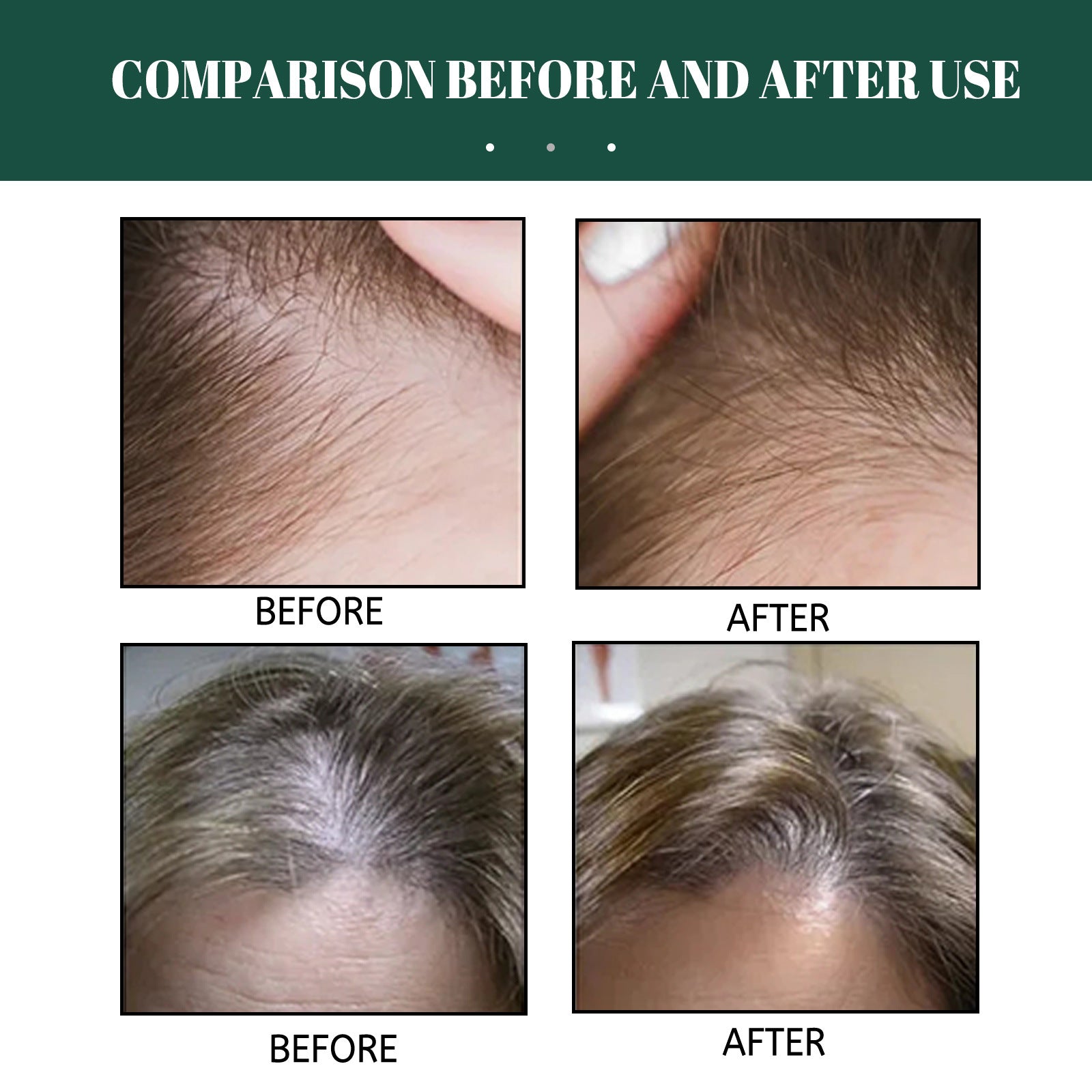 OUHOE Ginger Hair Care Serum 30ml – Scalp & Root Care | Aladinae