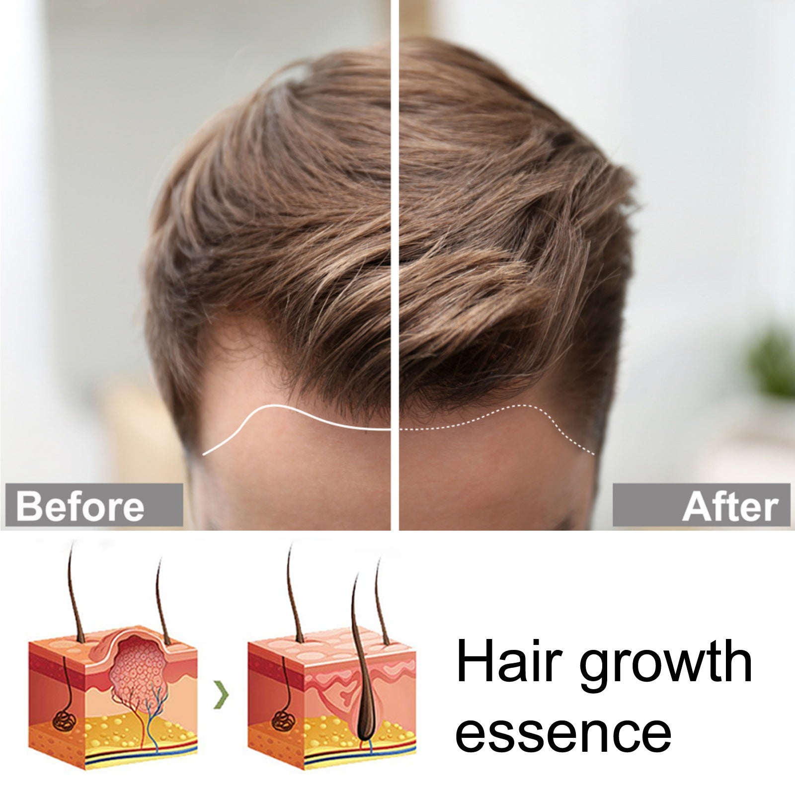 OUHOE Ginger Hair Care Serum 30ml – Scalp & Root Care | Aladinae
