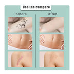 South Moon Skin Tone Concealer Patches, Waterproof Skin Tone Invisible Patches for Skin Scars, Tattoos, Acne Marks