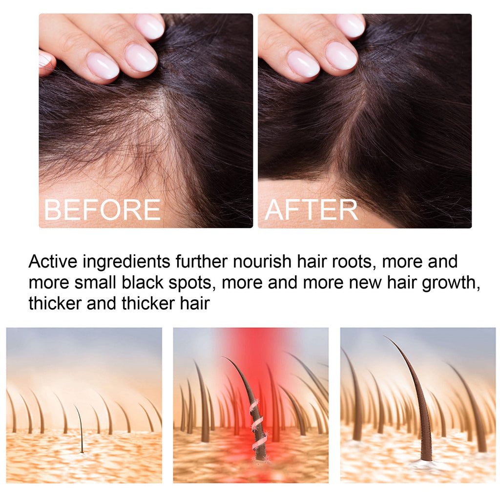 OUHOE Ginger Hair Care Serum 30ml – Scalp & Root Care | Aladinae
