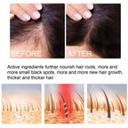 OUHOE Ginger Hair Care Serum 30ml – Scalp & Root Care | Aladinae