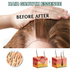OUHOE Ginger Hair Care Serum 30ml – Scalp & Root Care | Aladinae