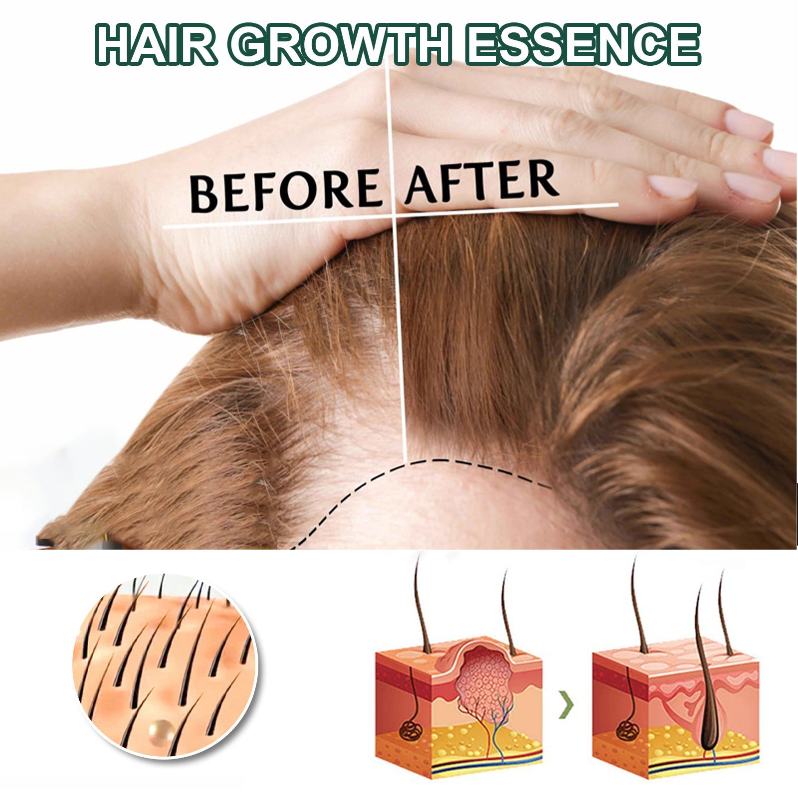 OUHOE Ginger Hair Care Serum 30ml – Scalp & Root Care | Aladinae