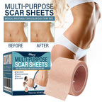 South Moon Skin Tone Concealer Patches, Waterproof Skin Tone Invisible Patches for Skin Scars, Tattoos, Acne Marks