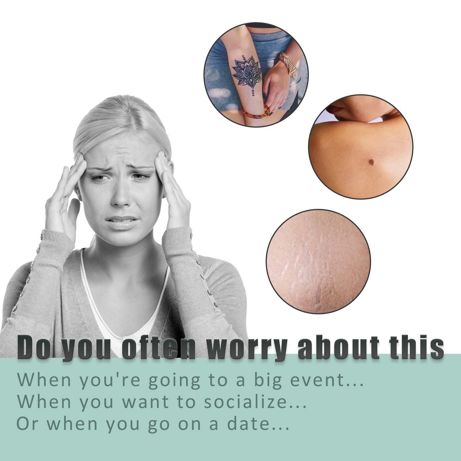 South Moon Skin Tone Concealer Patches, Waterproof Skin Tone Invisible Patches for Skin Scars, Tattoos, Acne Marks