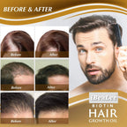 iBeaLee Anti-Hair Loss Hair Care Essence 20ml | Aladinae