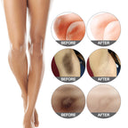 Jaysuing Skin Care: Moisturizes and brightens, fades dark spots on elbows, knees, and joints, exfoliates, and whitens.