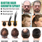iBeaLee Anti-Hair Loss Hair Care Essence 20ml | Aladinae