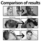 West&Month Hair Thickening Spray – Scalp & Beard Care | Aladinae