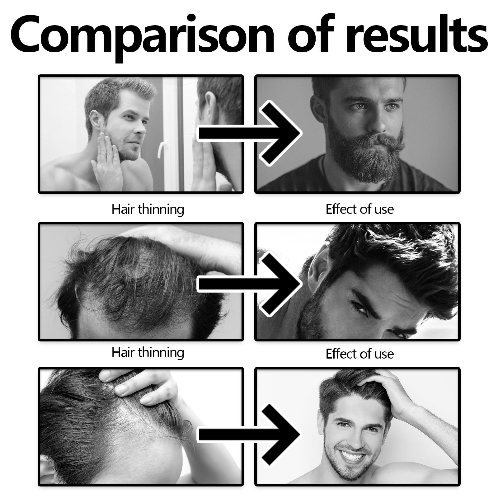 West&Month Hair Thickening Spray – Scalp & Beard Care | Aladinae